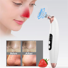 Load image into Gallery viewer, Rimad Pack blackhead remover tool