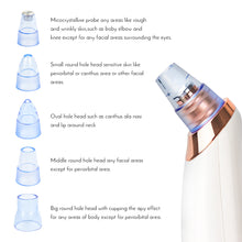 Load image into Gallery viewer, Korbin Pack blackhead remover tool