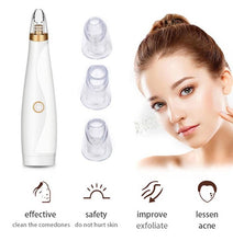 Load image into Gallery viewer, Palop blackhead remover tool