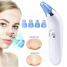 Load image into Gallery viewer, Vlitter best blackhead remover for nose