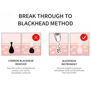 Beildar blackhead remover tool